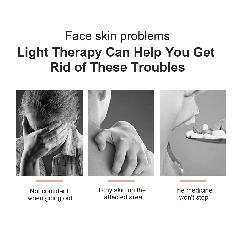 UVB-lamp Vitiligo Fysiotherapi - Candle Making Supplies Uk recensie en prijs